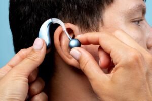 Cochlear Implant क्या है