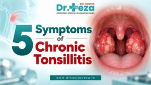 5 Symptoms of Chronic Tonsillitis