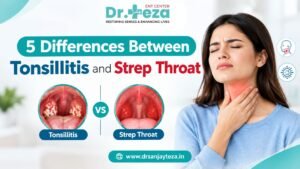 Tonsillitis and Strep Throat